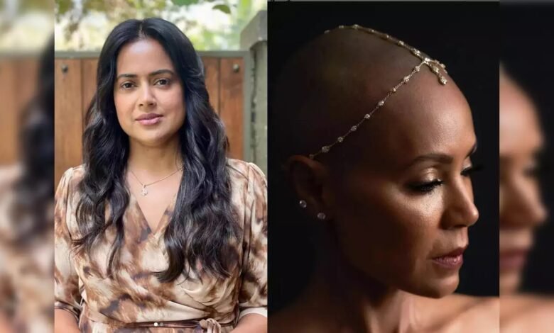 Alopecia