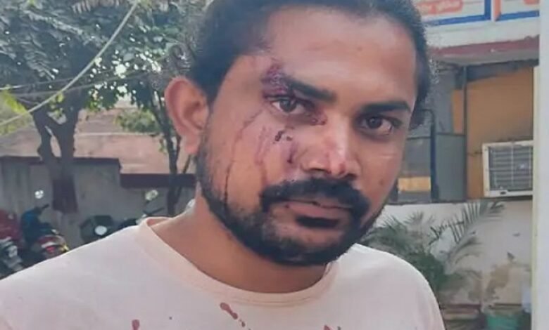 ग्रेटर नोएडा, नोएडा: जीजा ने साले को डंडे से पीट-पीटकर किया लहूलुहान