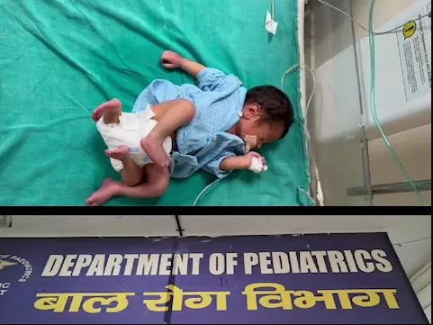 उत्तर प्रदेश,नोएडा: बाल चिकित्सालय में न्यूरो सहित तीन विभाग बंद