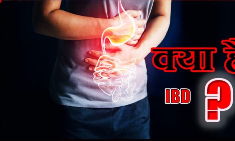 आईबीडी