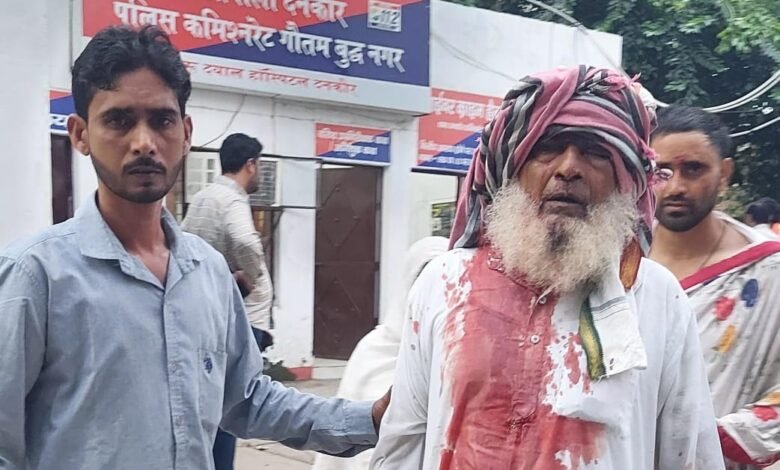 उत्तर प्रदेश, नोएडा: ग्रेटर नोएडा में परिवार पर हमला