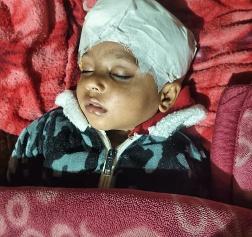 stray dog attack Ghaziabad, Indirapuram dog menace