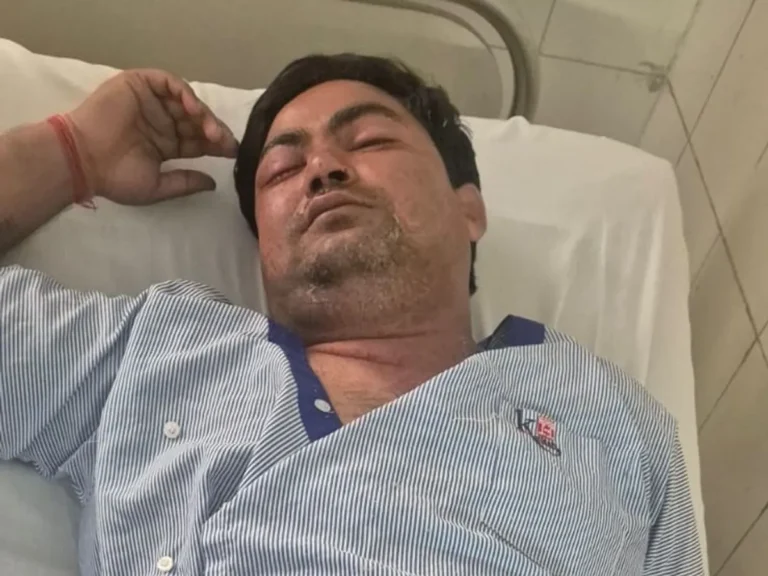 Greater Noida Firing: ग्रेटर नोएडा में मैरिज होम संचालक के घर फायरिंग, गेट खोलते ही चली गोली, चाचा घायल