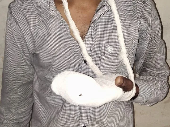 Noida Factory Accident: चार्जर कंपनी में बड़ा हादसा, मशीन की चपेट में आने से युवक की अंगुलियां कटीं