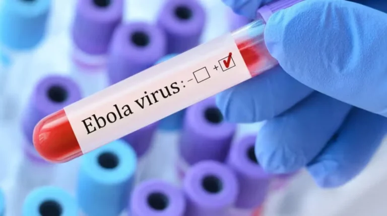 Ebola: इबोला को लेकर बड़ी राहत, बेंगलुरु का संदिग्ध मामला निकला नेगेटिव, देश में कोई पुष्ट केस नहीं