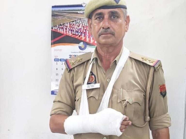 Noida Police: मोबाइल स्नैचर को पकड़ने में टीएसआई की उंगली टूटी, घायल होने के बावजूद नहीं छोड़ा आरोपी