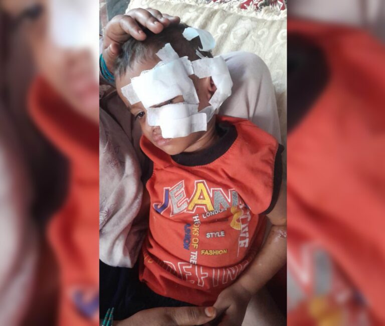 Uttar Pradesh : हापुड़ में आवारा कुत्ते ने पांच लोगों को काटा, आठ वर्षीय बालक गंभीर, मेरठ में चल रहा उपचार